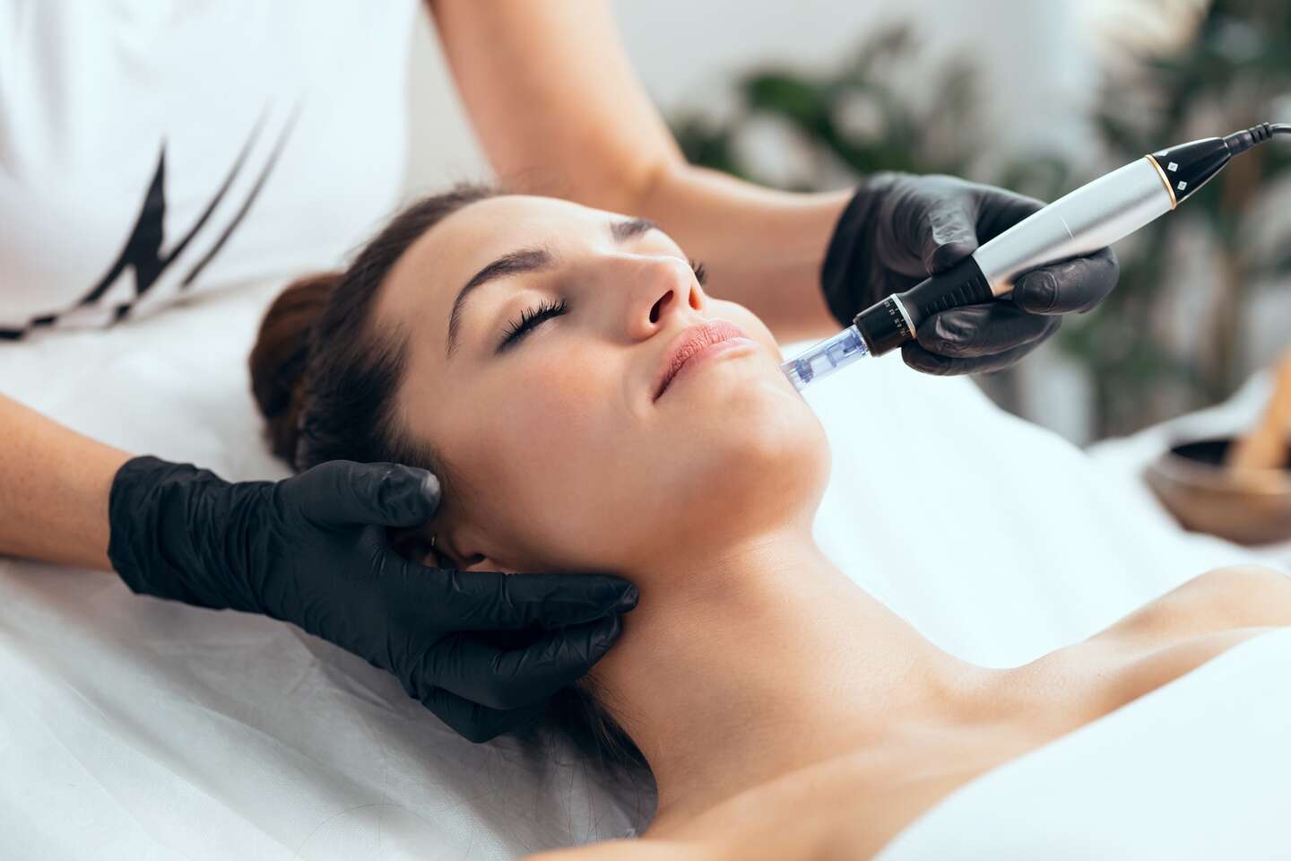 Mezoterapia pleti